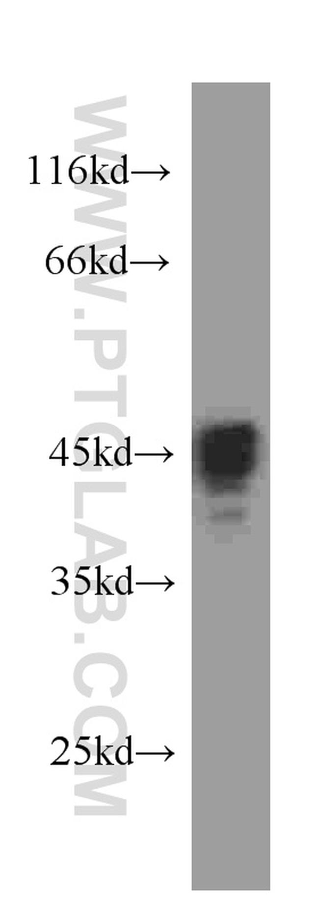 GFAP Antibody in Western Blot (WB)