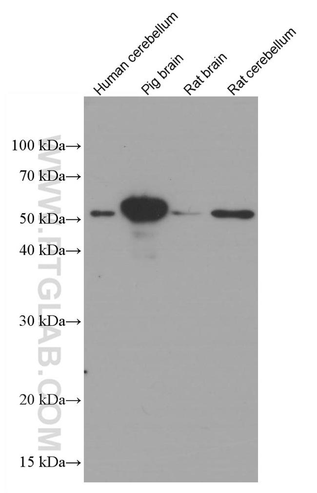 GFAP Antibody in Western Blot (WB)