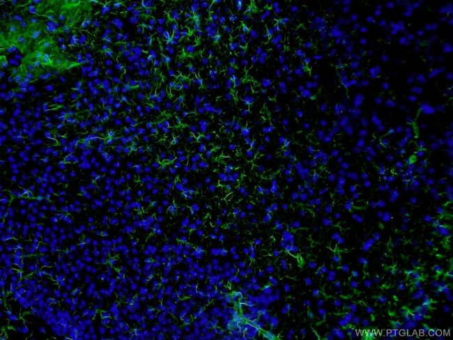 GFAP Antibody in Immunohistochemistry (PFA fixed) (IHC (PFA))