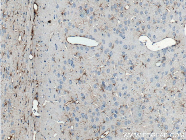 GFAP Antibody in Immunohistochemistry (Paraffin) (IHC (P))