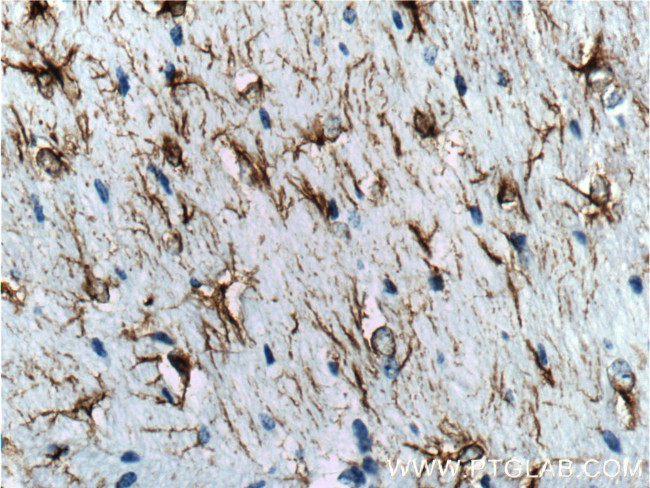 GFAP Antibody in Immunohistochemistry (Paraffin) (IHC (P))