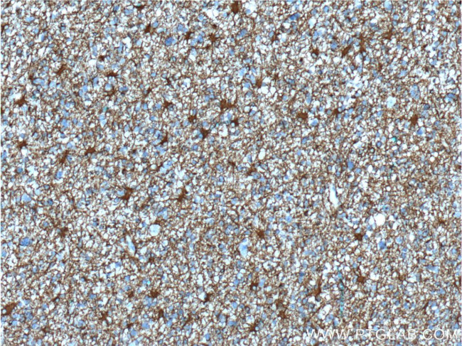 GFAP Antibody in Immunohistochemistry (Paraffin) (IHC (P))