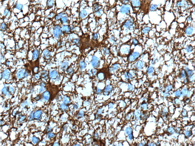 GFAP Antibody in Immunohistochemistry (Paraffin) (IHC (P))