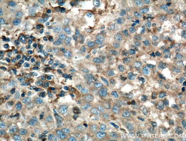 TNFR1 Antibody in Immunohistochemistry (Paraffin) (IHC (P))