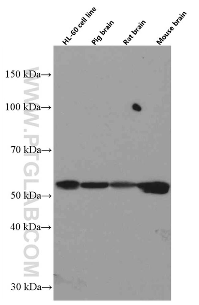 TNFR1 Antibody in Western Blot (WB)