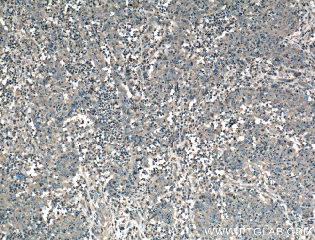 TNFR1 Antibody in Immunohistochemistry (Paraffin) (IHC (P))