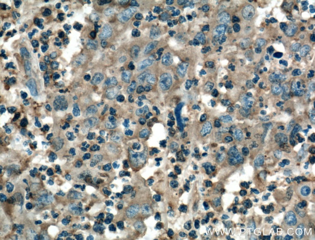 TNFR1 Antibody in Immunohistochemistry (Paraffin) (IHC (P))