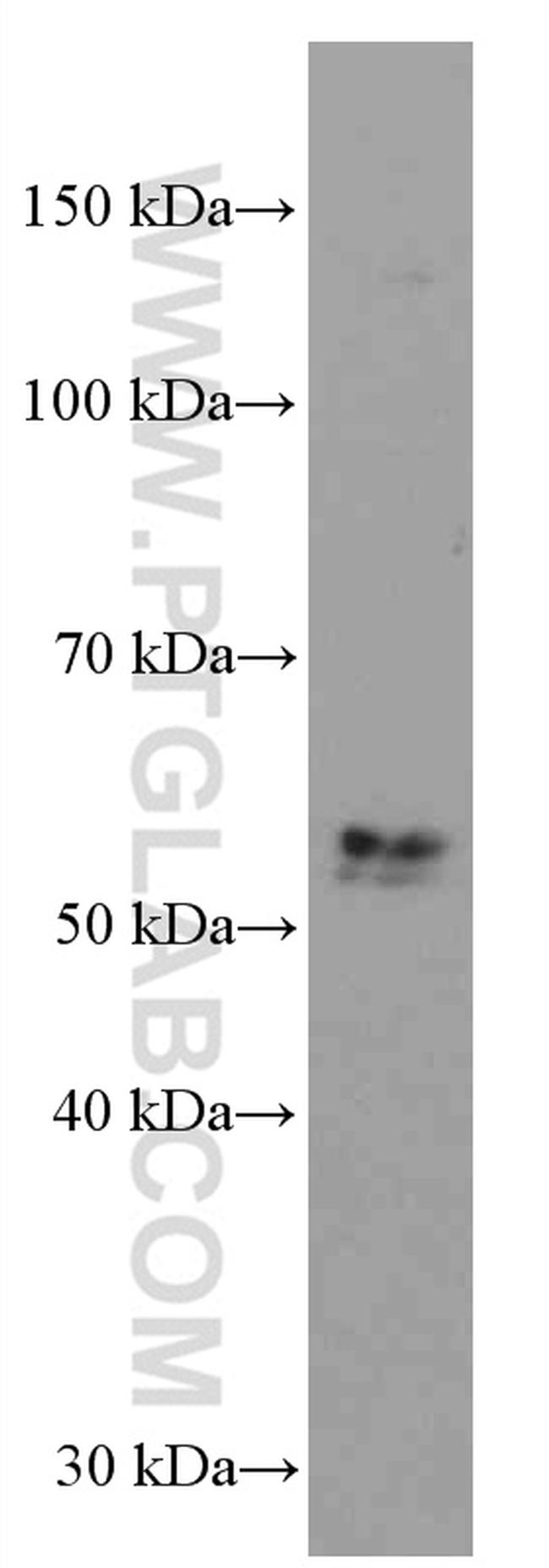 TNFR1 Antibody in Western Blot (WB)