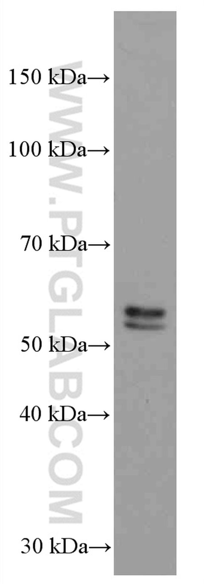 TNFR1 Antibody in Western Blot (WB)