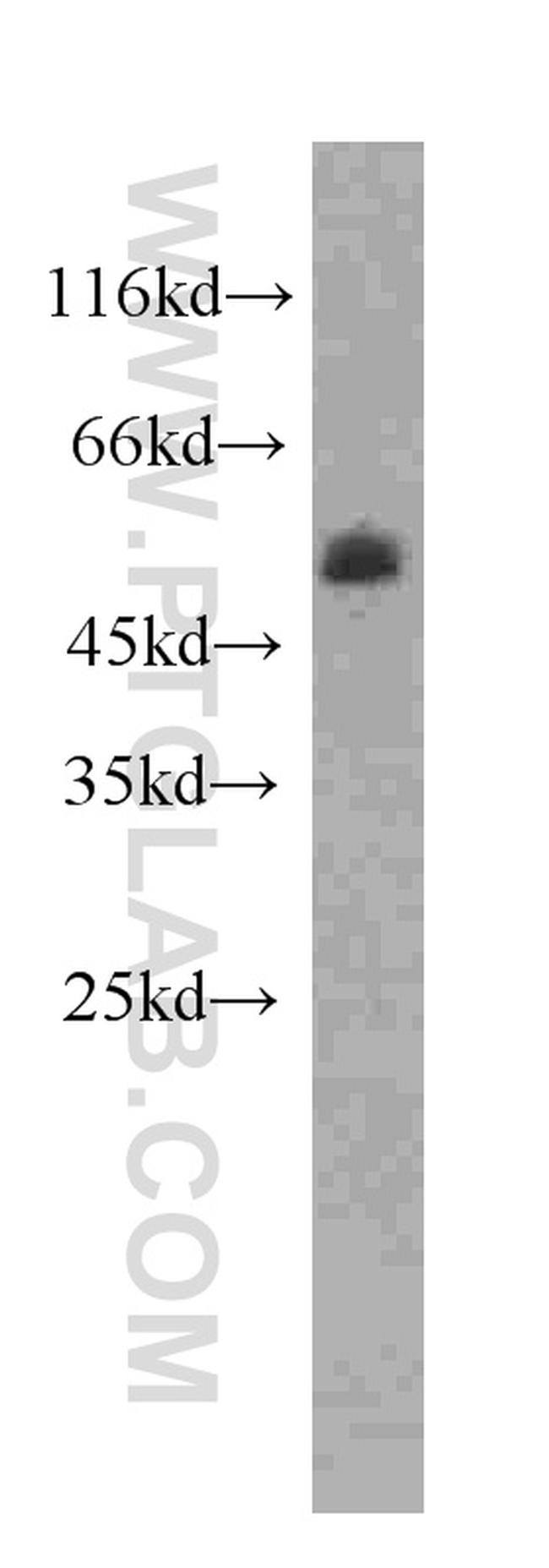 PPARD Antibody in Western Blot (WB)