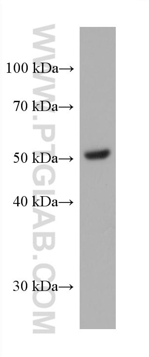 PPARD Antibody in Western Blot (WB)