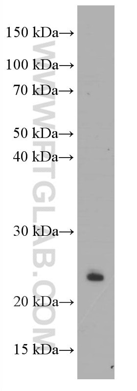 CD3 delta Antibody in Western Blot (WB)