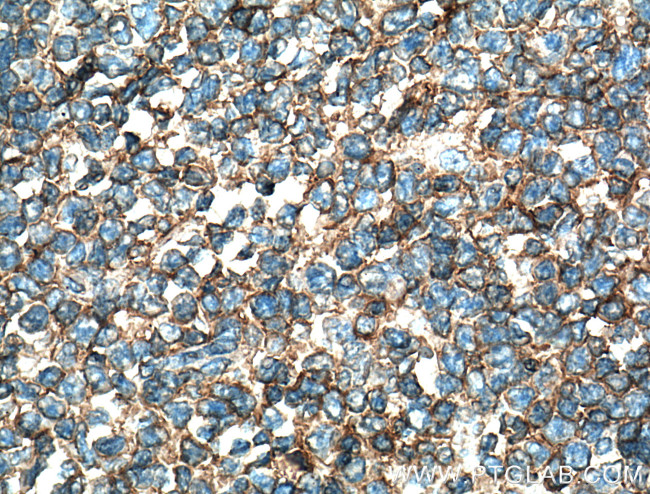 FAS/CD95 Antibody in Immunohistochemistry (Paraffin) (IHC (P))