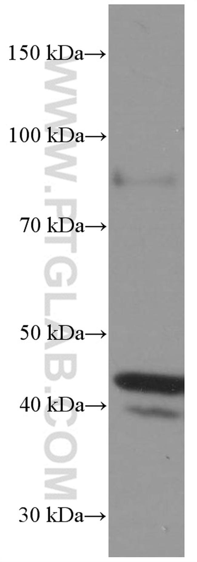 FAS/CD95 Antibody in Western Blot (WB)