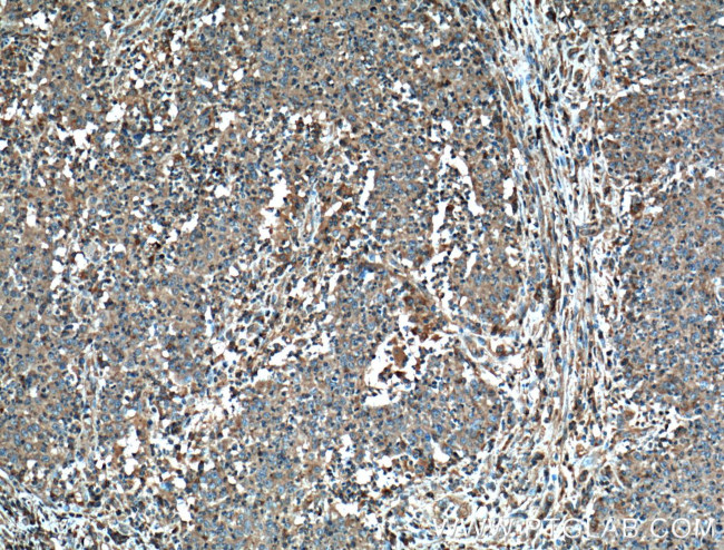 FAS/CD95 Antibody in Immunohistochemistry (Paraffin) (IHC (P))