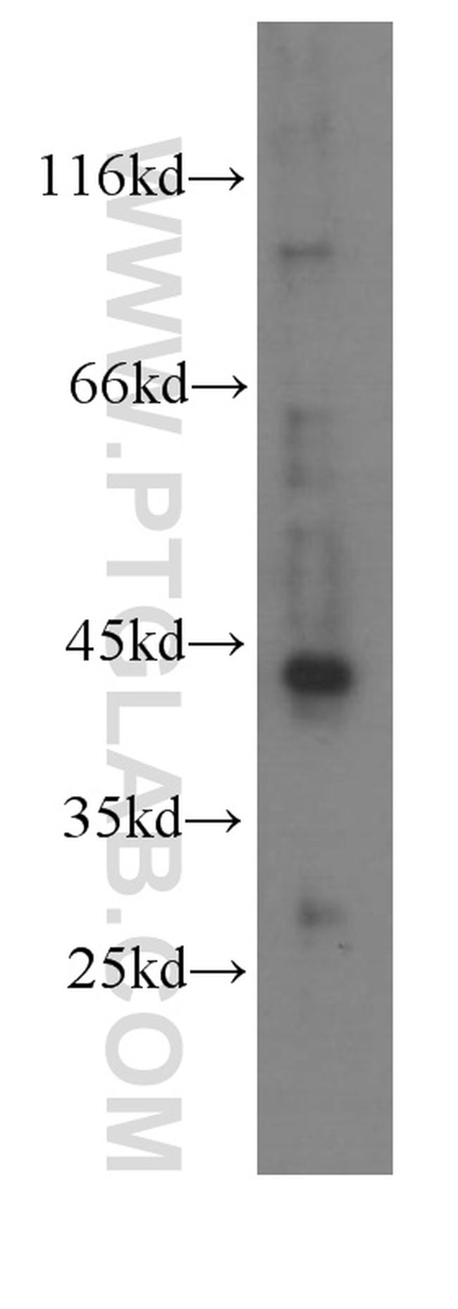 RXRA Antibody in Western Blot (WB)