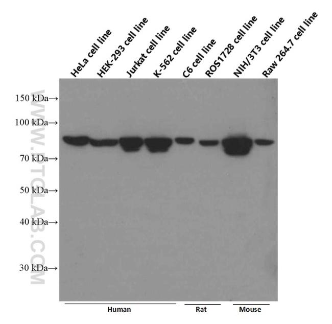 STAT3 Antibody in Western Blot (WB)