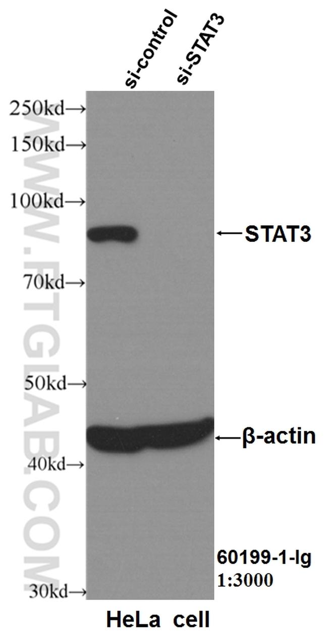 STAT3 Antibody in Western Blot (WB)