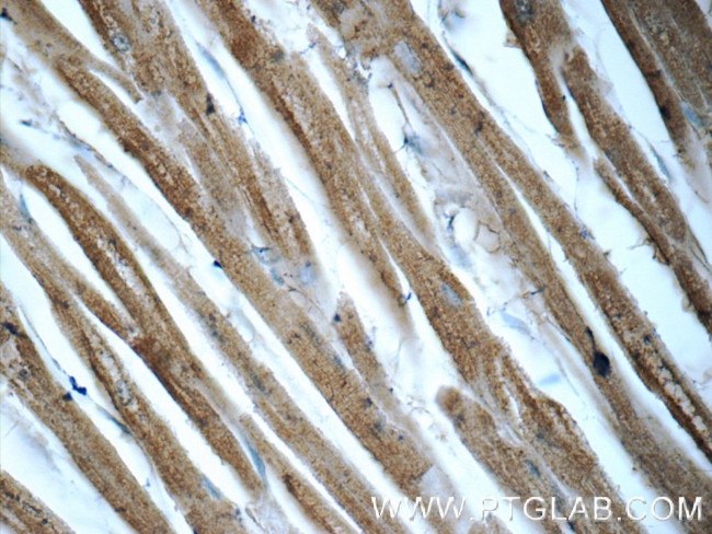 STAT3 Antibody in Immunohistochemistry (Paraffin) (IHC (P))