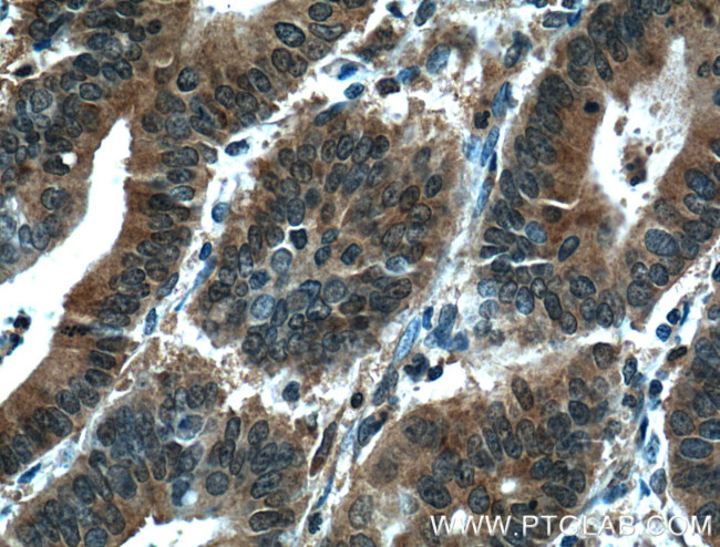 STAT3 Antibody in Immunohistochemistry (Paraffin) (IHC (P))