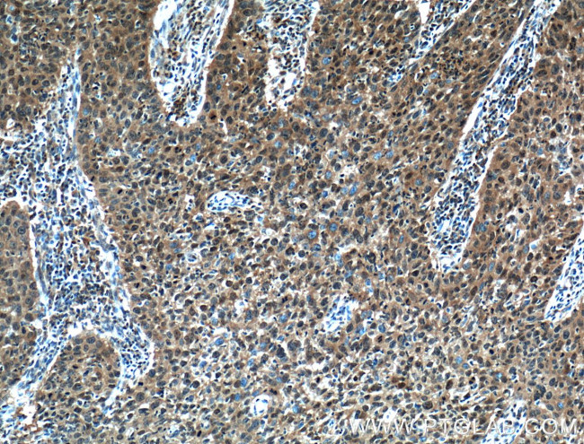 STAT3 Antibody in Immunohistochemistry (Paraffin) (IHC (P))