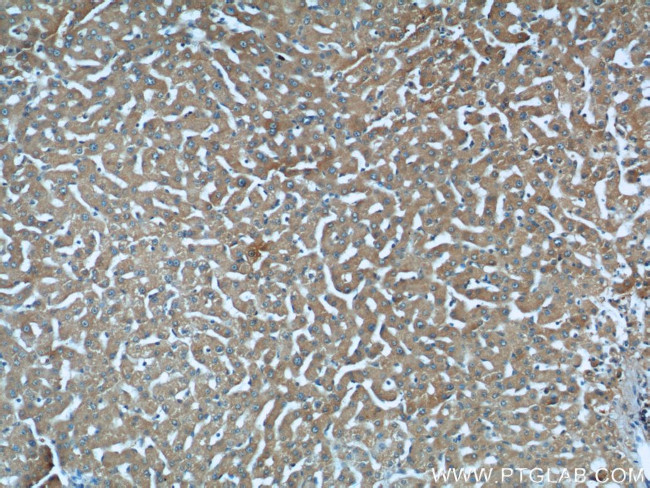 STAT3 Antibody in Immunohistochemistry (Paraffin) (IHC (P))