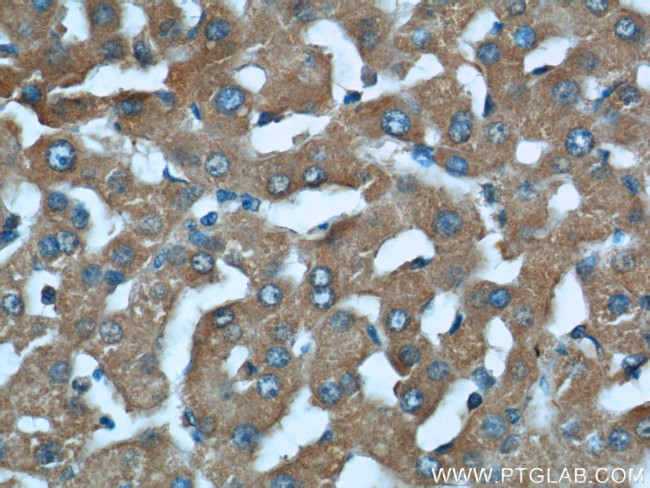 STAT3 Antibody in Immunohistochemistry (Paraffin) (IHC (P))