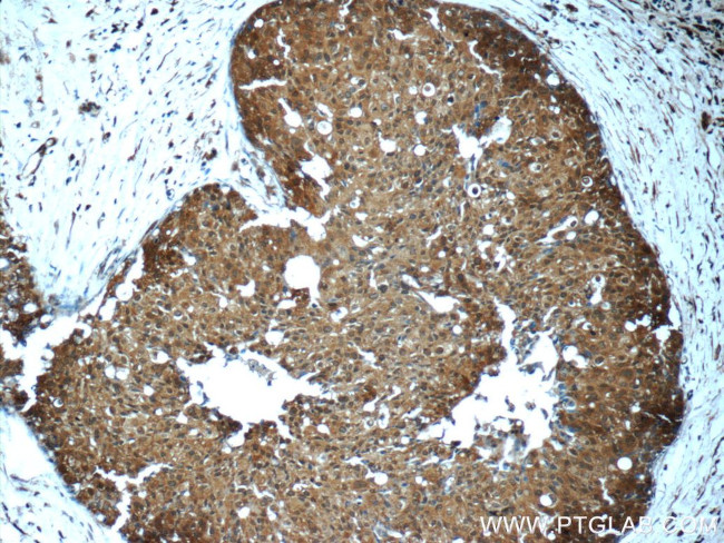 STAT3 Antibody in Immunohistochemistry (Paraffin) (IHC (P))