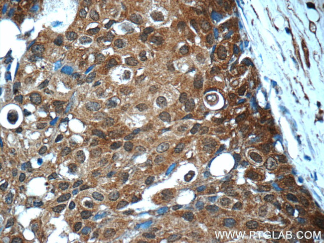 STAT3 Antibody in Immunohistochemistry (Paraffin) (IHC (P))