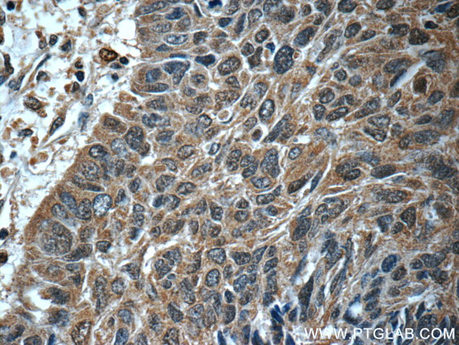 STAT3 Antibody in Immunohistochemistry (Paraffin) (IHC (P))