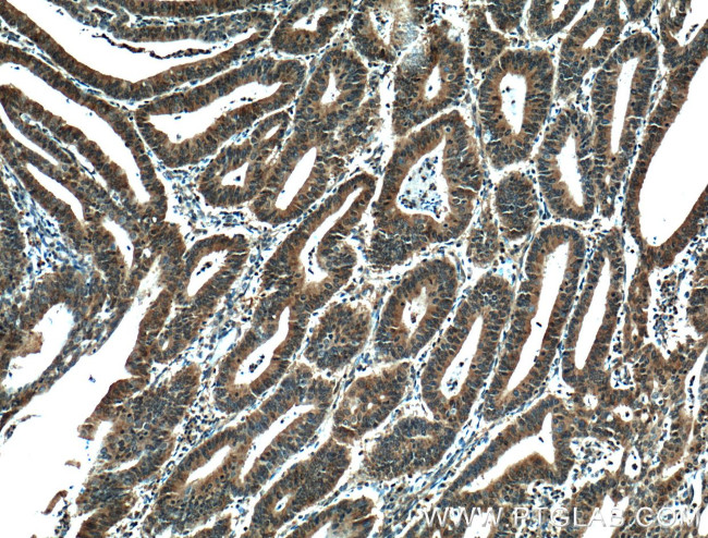 STAT3 Antibody in Immunohistochemistry (Paraffin) (IHC (P))