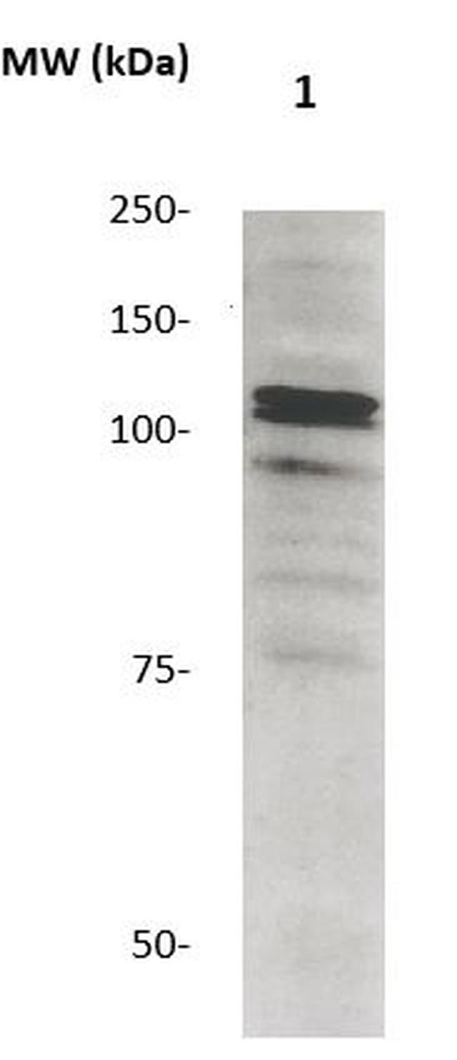 Phospho-Catenin-Delta1 (Tyr96) Antibody in Western Blot (WB)