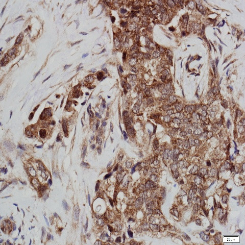 Phospho-GSK-3b (Tyr216) Antibody in Immunohistochemistry (Paraffin) (IHC (P))