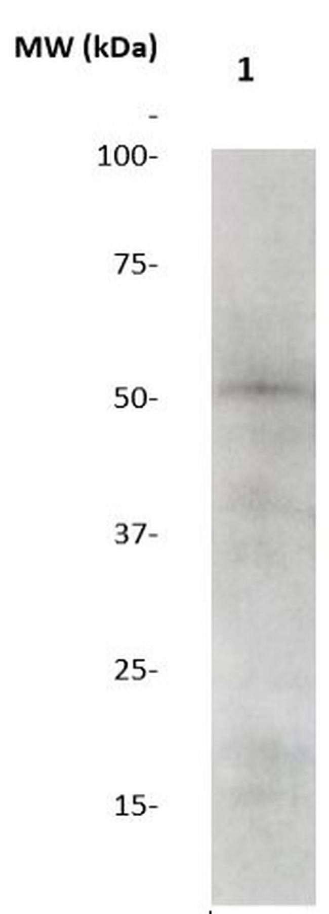 GSK-3b Antibody in Western Blot (WB)