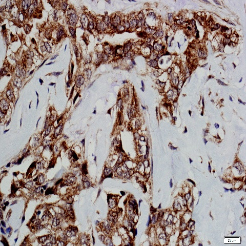 GSK-3b Antibody in Immunohistochemistry (Paraffin) (IHC (P))