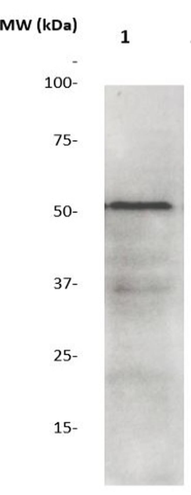 GSK-3b Antibody in Western Blot (WB)