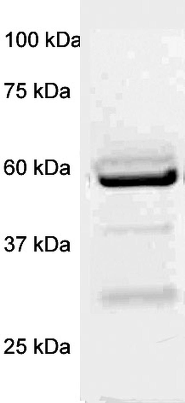 p56-LCK (LSK) Antibody in Western Blot (WB)