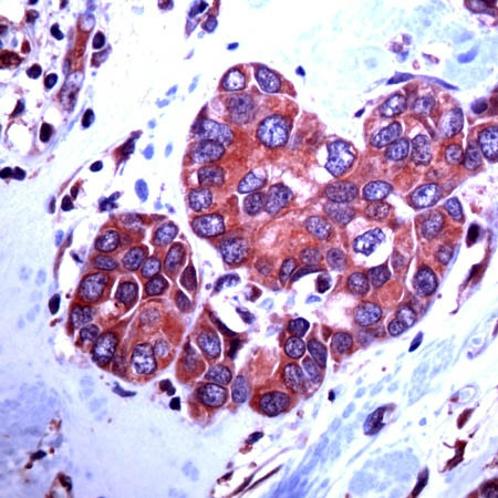 Paxillin Antibody in Immunohistochemistry (Paraffin) (IHC (P))