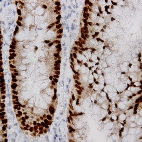 Cdk9 Antibody in Immunohistochemistry (Paraffin) (IHC (P))