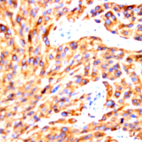 FLT1 Peptide Antibody in Immunohistochemistry (Paraffin) (IHC (P))