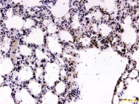 FOXP2 Antibody in Immunohistochemistry (Paraffin) (IHC (P))