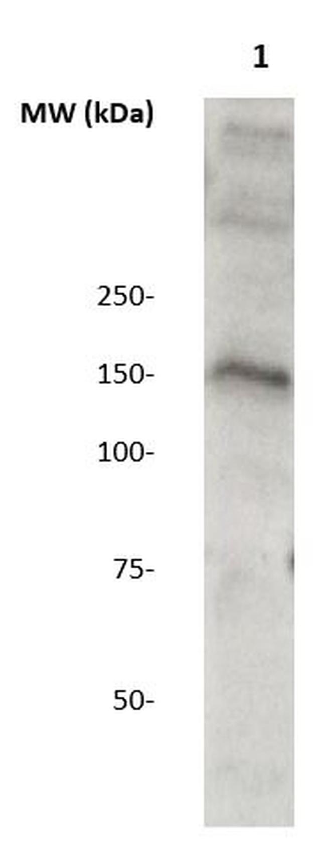 WDR19 Antibody in Western Blot (WB)