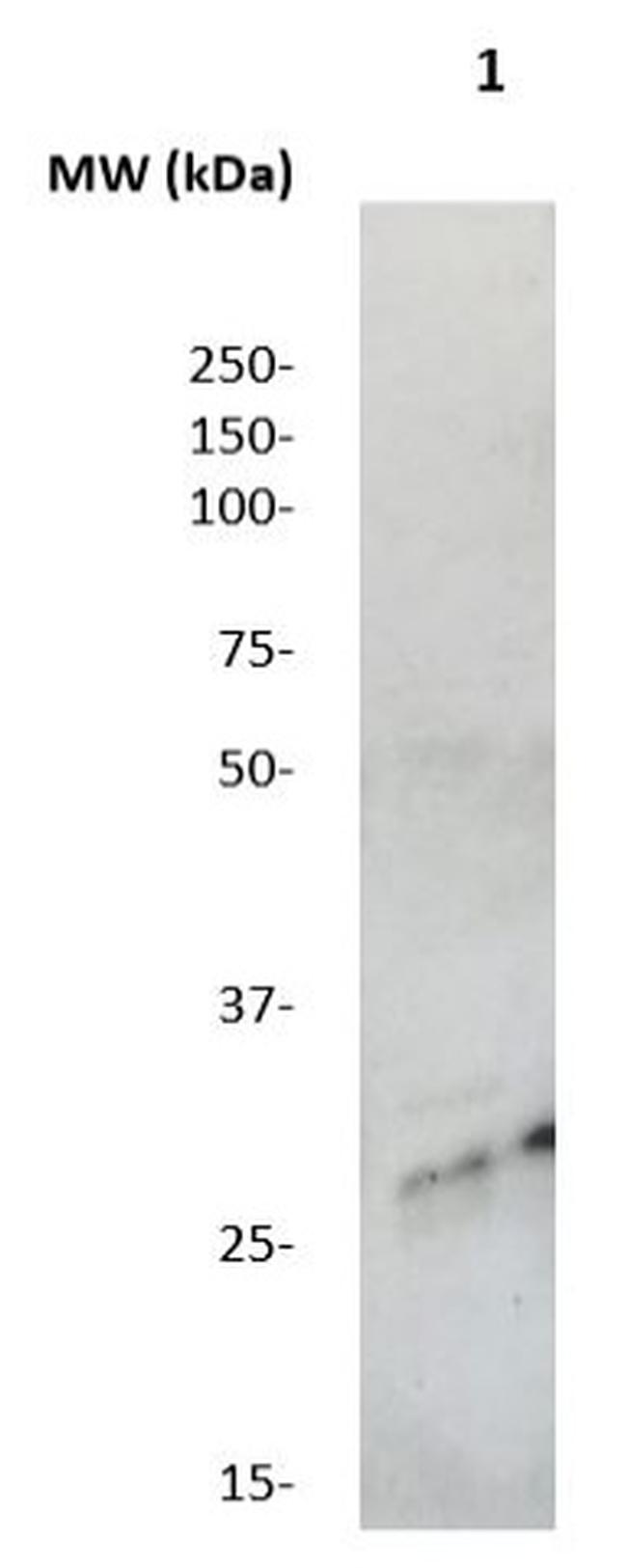 NPPB Antibody in Western Blot (WB)