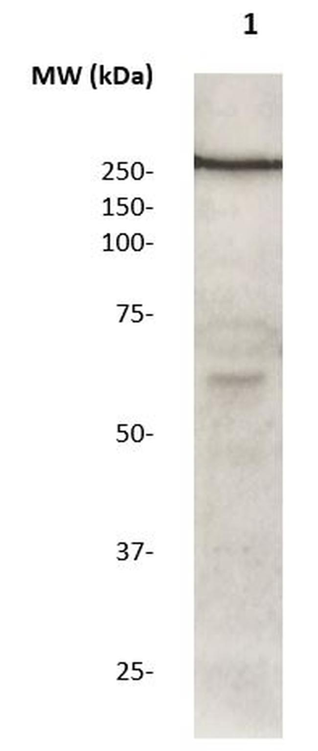 LRRK2 Antibody in Western Blot (WB)