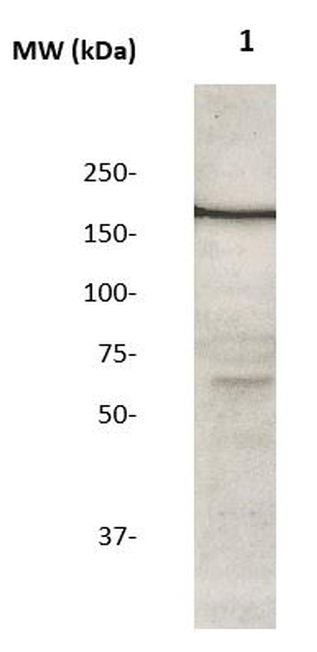 IRS-2 Antibody in Western Blot (WB)