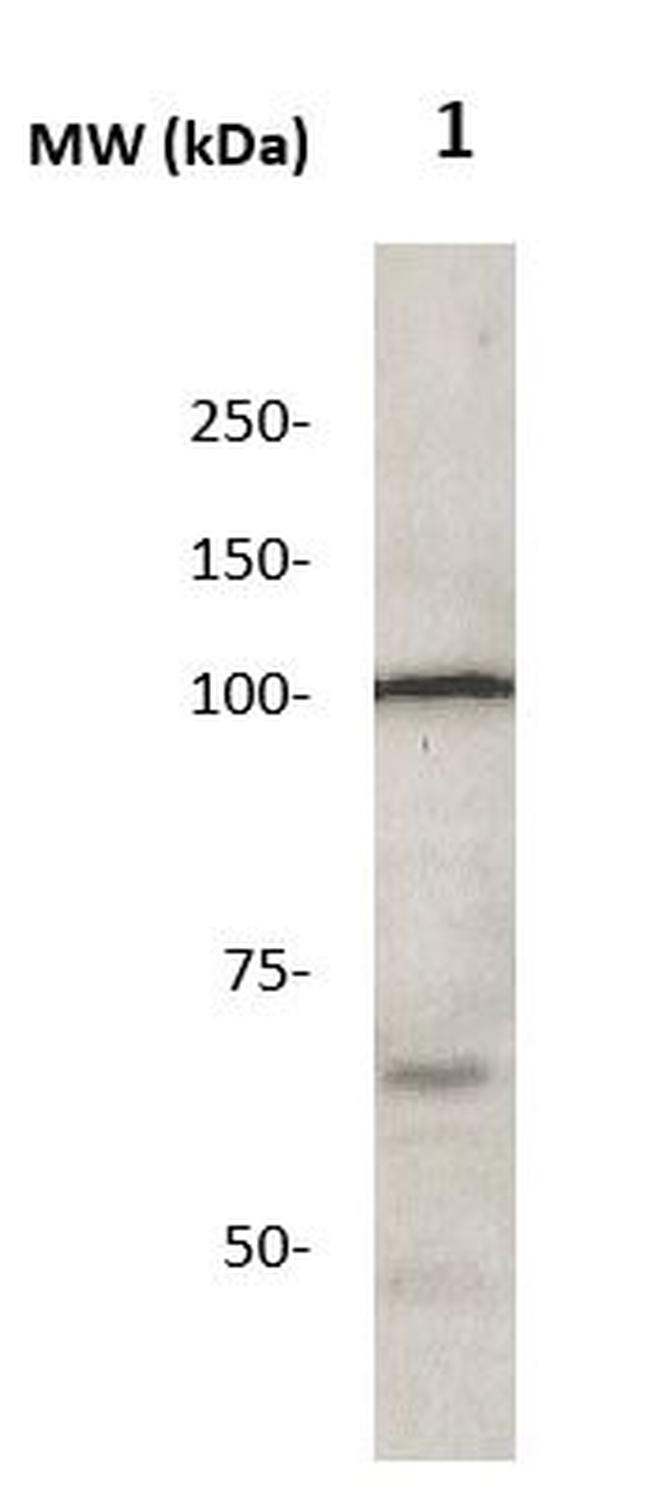 Corin Antibody in Western Blot (WB)