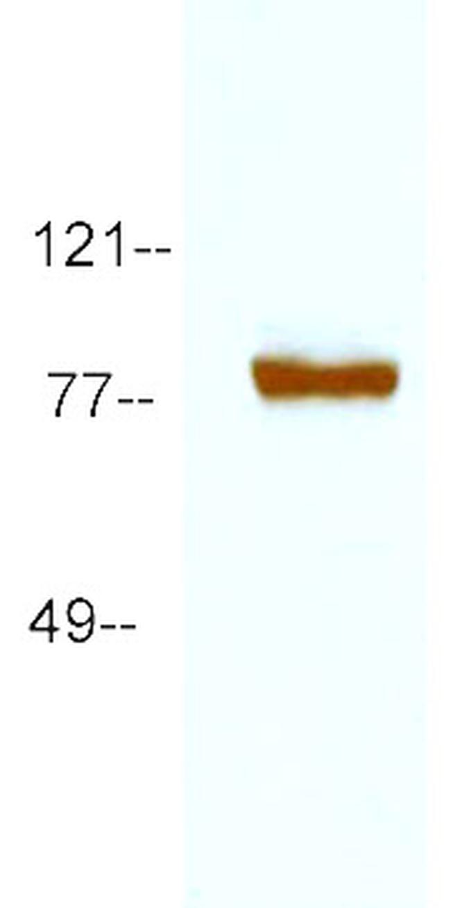 Shaker Antibody in Western Blot (WB)