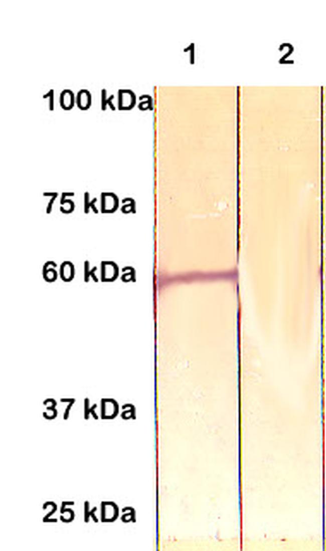 ER81 Antibody in Western Blot (WB)