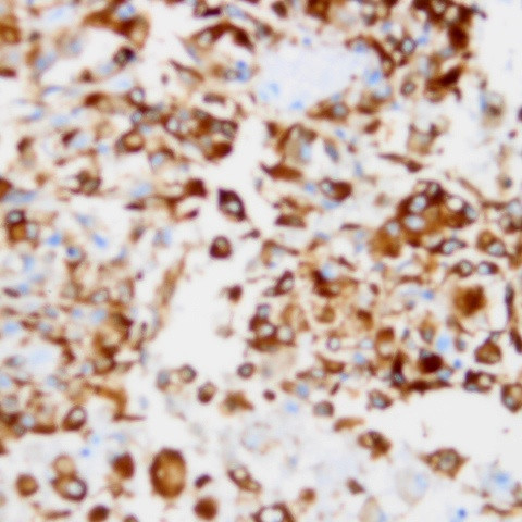 Melanoma/NG2 Antibody in Immunohistochemistry (PFA fixed) (IHC (PFA))