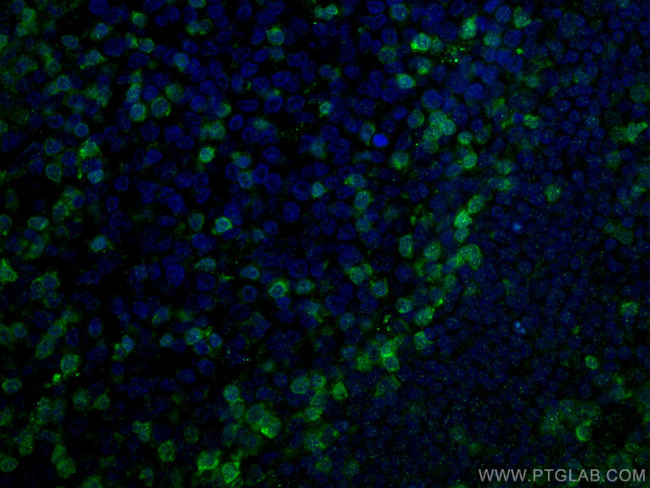 ZAP70 Antibody in Immunohistochemistry (PFA fixed) (IHC (PFA))